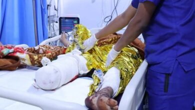 مواطن بترت قدمه نتيجة لغم حوثي