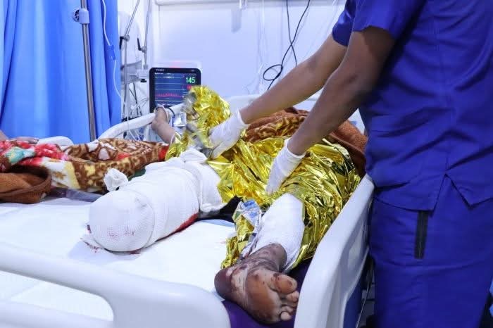 مواطن بترت قدمه نتيجة لغم حوثي