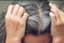 الشعر الأبيض