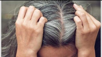 الشعر الأبيض